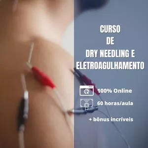 Dry Needling (Agulhamento a Seco) & EletroAgulhamento 4.0