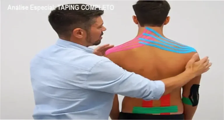 Capa informativa sobre o tema TAPING COMPLETO