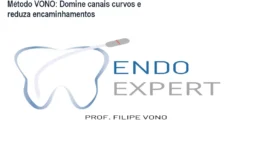 Método VONO: Domine canais curvos e reduza encaminhamentos