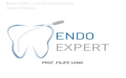 Método VONO: Curso de Endodontia para Canais Complexos