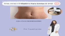 Curso Tratamento Definitivo Para Estrias – Reduza Marcas