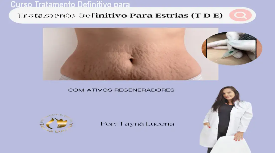 Curso Tratamento Definitivo para Estrias – Reduza Marcas