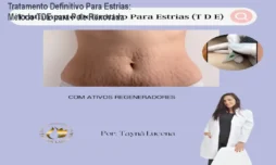 Tratamento Definitivo Para Estrias: Método TDE para Pele Renovada
