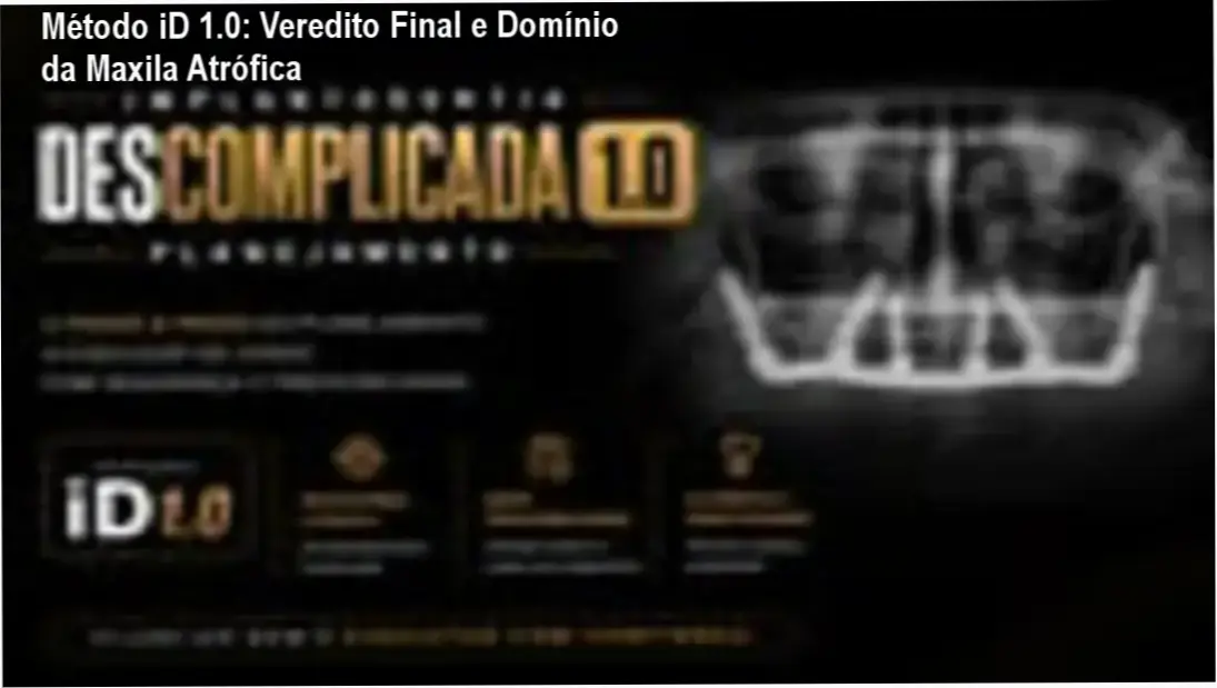 Detalhes do treinamento Método iD 1.0 do Dr. Leonardo Lafuente sobre implantodontia prática