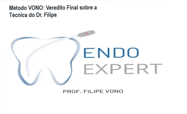 Kit de limas do Método VONO para instrumentação de canais curvos e complexos